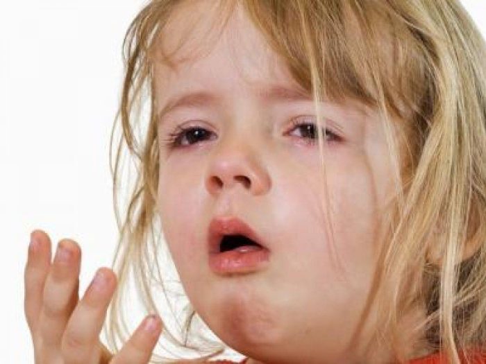 علاج الكحة الجافة عند الأطفال