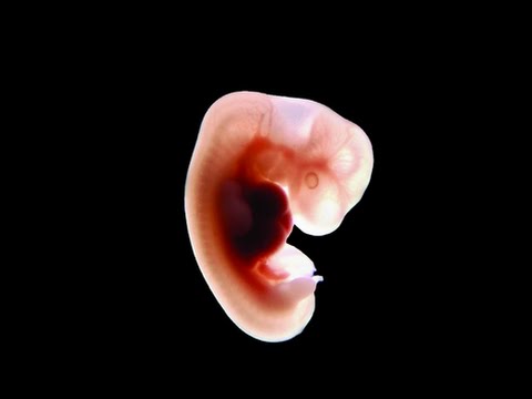 شكل الجنين في الشهر الأول من الحمل بالصور