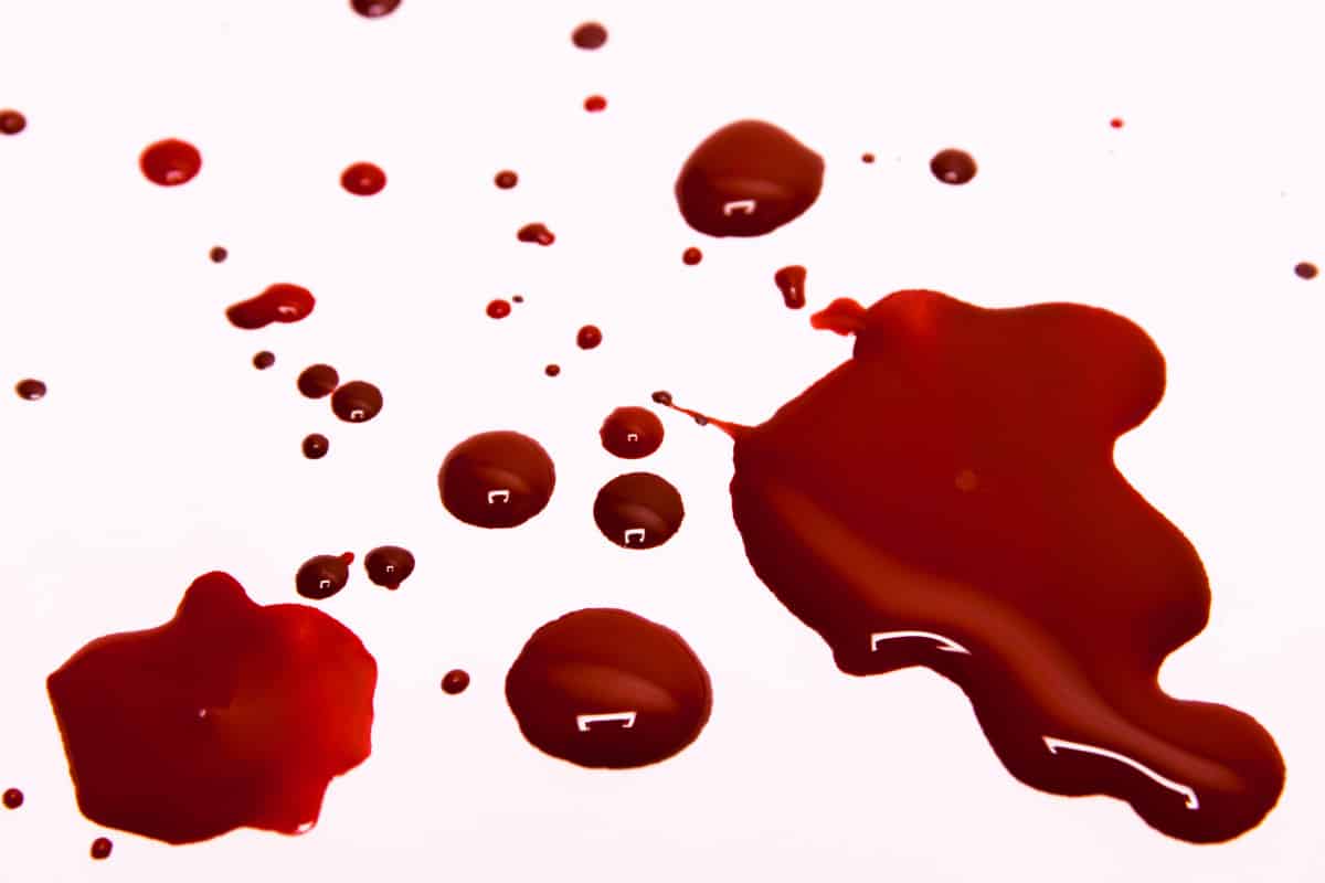 متى يكون الدم الناتج عن الإجهاض خطير