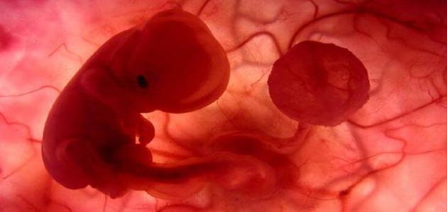الآثار الجانبية لموت الجنين في الشهر الثاني بدون نزيف