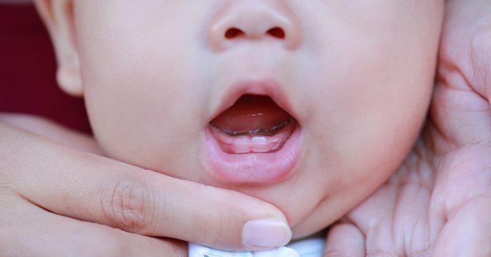 الطرق المتبعة للحفاظ على أسنان الطفل بعد ظهورها