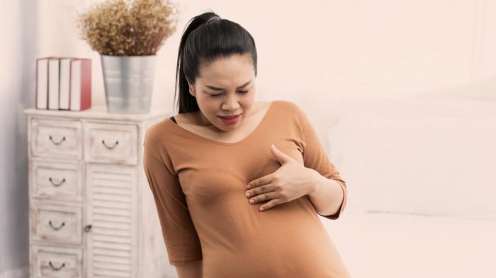حرقة المعدة عند الحامل وجنس الجنين
