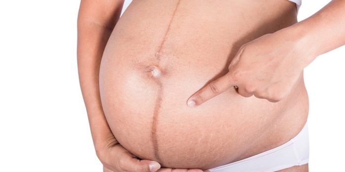 خط الحمل في البطن وجنس الجنين