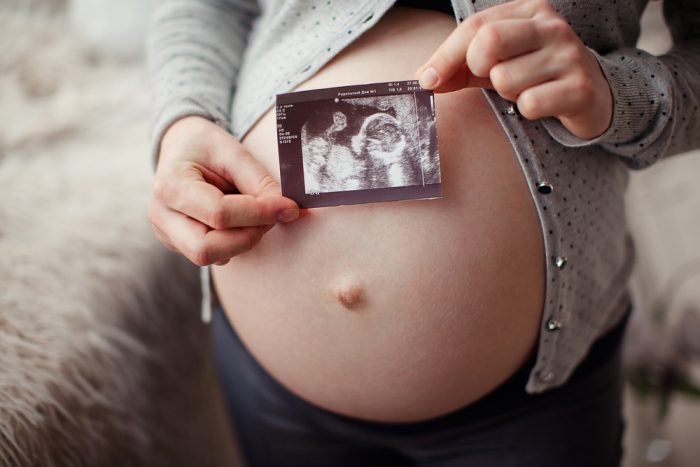 شكل السرة للحامل ونوع الجنين