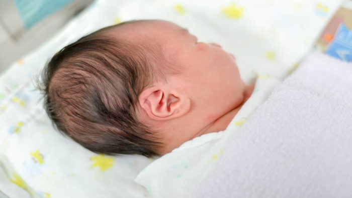 ما الأسباب التي تجعل شكل رأس الرضيع غير مستويا