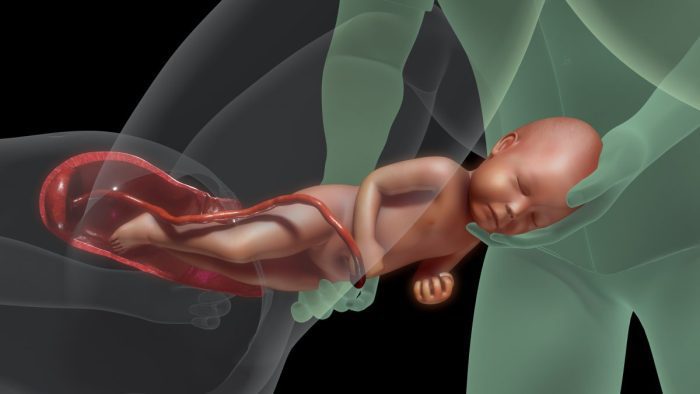 تفسير حلم خروج الجنين من البطن للحامل
