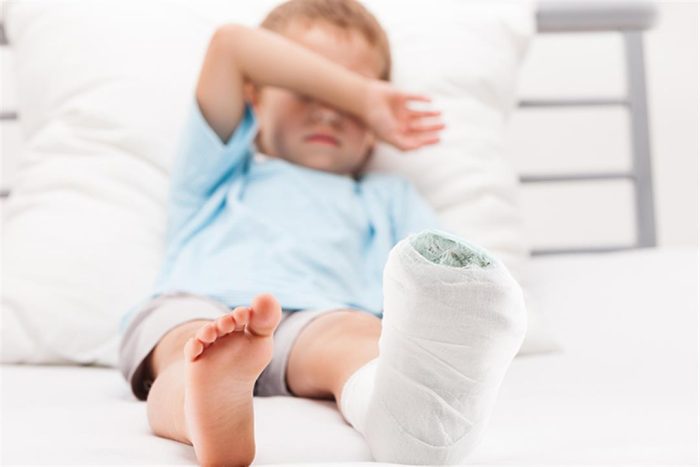 مدة التئام عظام الساق عند الأطفال