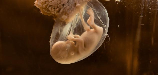 شكل كيس الحمل بعد الإجهاض بالصور