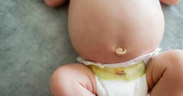 انتفاخ البطن عند الاطفال