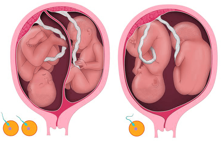 مراحل نمو الجنين التوأم بالأسابيع بالصور