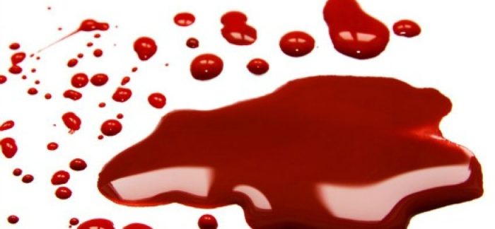 تفسير حلم نزيف الدم للحامل