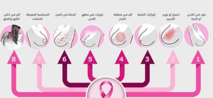 أول علامات سرطان الثدي ظهورًا بالصور