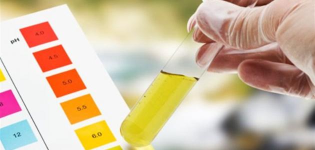 أهمية تحليل urine analysis للحامل