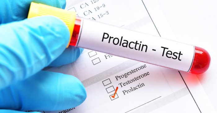 تحليل prolactin للنساء الطبيعي