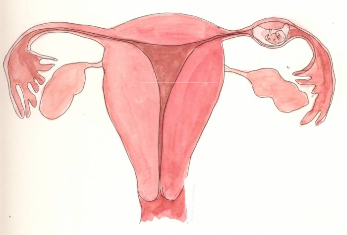 متى يكتشف الحمل خارج الرحم بالسونار