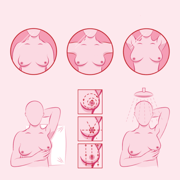 طريقة الكشف عن سرطان الثدي بالصور
