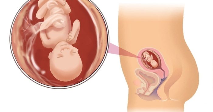 مغص أسفل البطن في الشهر السادس من الحمل