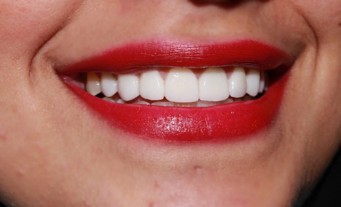 معايير جمال الأسنان
